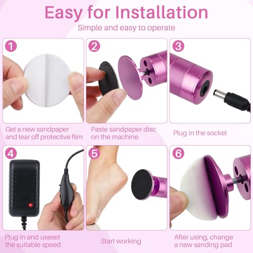 SENROU Electric Foot Callus Remover - 2-in-1 Filer & Nail Filer, 1 Count (Pink)