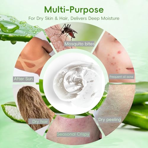 Organic Aloe Vera Gel 99% Pure - Soothing Skin Care for Sunburn Relief, 7.05oz