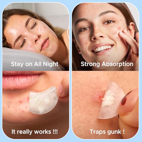 LitBear Large Pimple Patches - XL Hydrocolloid Acne Stickers (228 Count)