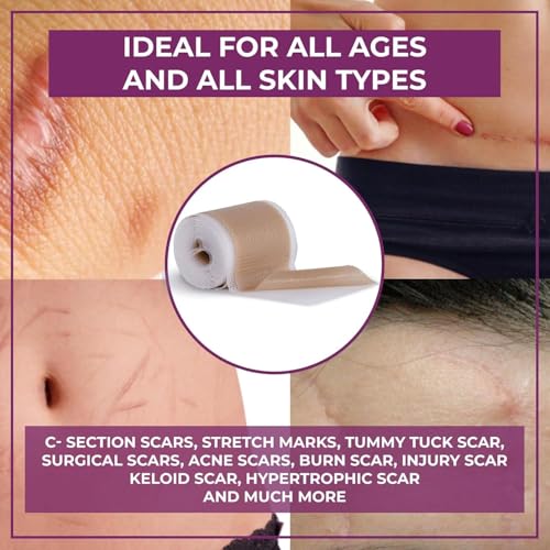 Healqu Medical Grade Silicone Scar Sheets - 1 Pack, 1.6x120in, Non-Irritating & Pain-Free for Surgical and Keloid Scars