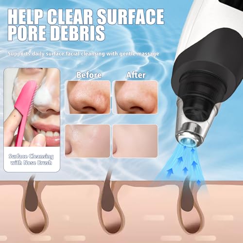 Gackoko Blackhead Remover Pore Vacuum with 3 Suction Levels & Brush Set