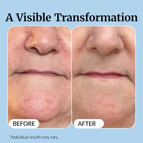 Vibriance Super C Serum for Mature Skin - All-in-One Vitamin Formula Hydrates, Firms, Lifts, Smooths, Targets Age Spots, Wrinkles, 1 fl oz