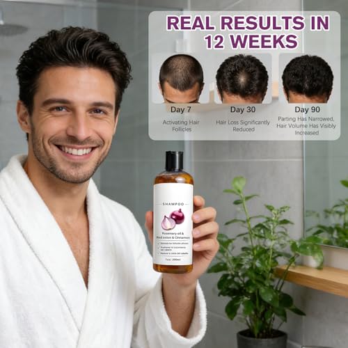 Rosemary Shampoo with Onion & Biotin for Hair Growth