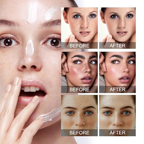 Crema para Manchas Oscuras en la Cara – 2 PCS, Eliminación de Pecas y Manchas