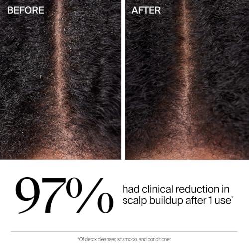 Neutrogena Hair Restore Triple Action Scalp Detox Cleanser, 8 fl oz