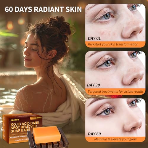 Kojic Acid Soap for Dark Spot Removal with Turmeric & Vitamin C - 2 Bars