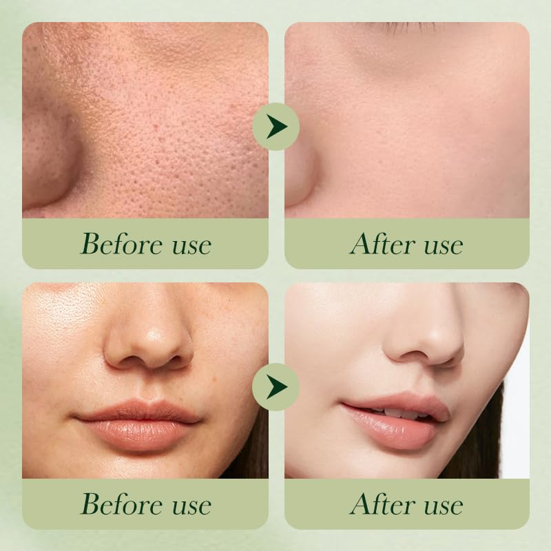 Avocado Skincare Set – 6-Piece Gift Box with Cleanser, Serum, Cream & More