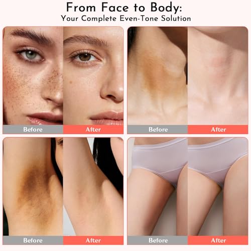 Skin Bleaching Cream for Dark Spots, Skin Lightening Whitening Brightening Cream, Dark Spot Remover for Body Face Intimate Areas, Underarm, Bikini Area, Inner Thigh, Knees and Elbows,100ml | Dark Spot Care