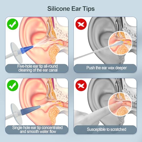 Ear Wax Removal Kit with Ear Tips, Basin & Irrigation System - Safe Ear Cleaning
