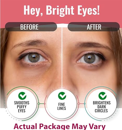 Look At Me Green Tea Under Eye Patches - 10 Pairs for Dark Circles