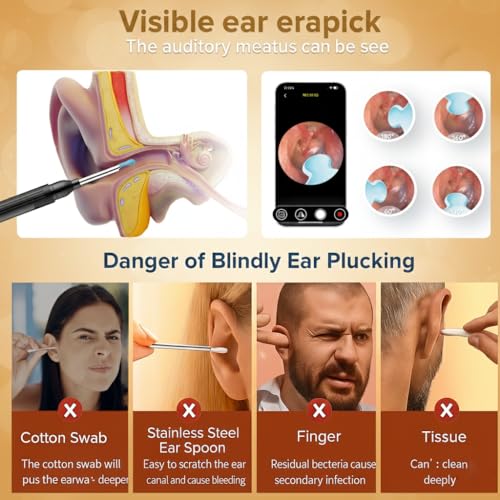 1296P HD Ear Wax Removal Tool with Camera & 8 Accessories