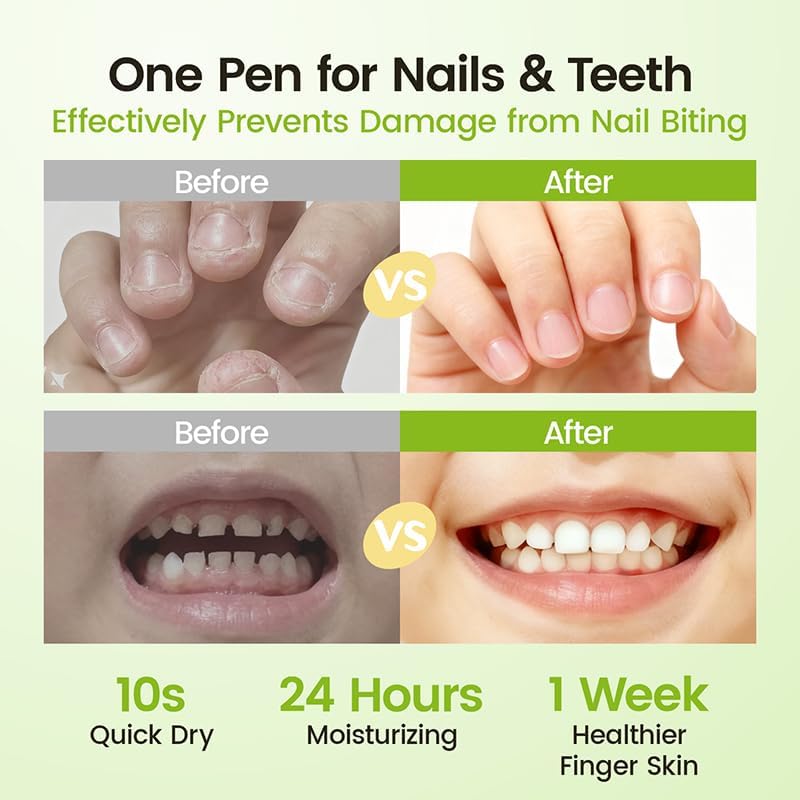 Stop Nail Biting for Kids - Bitter Taste Nail Care Pen | Safe, Non-Toxic Treatment for Ages 0+ (0.14 oz)