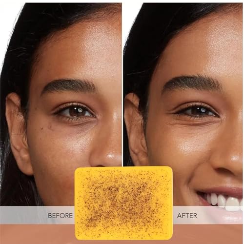 Uselective 3 Pack Lemon & Turmeric Soap Bar for Dark Spots - Kojic Acid & Shea Butter, SLS-Free