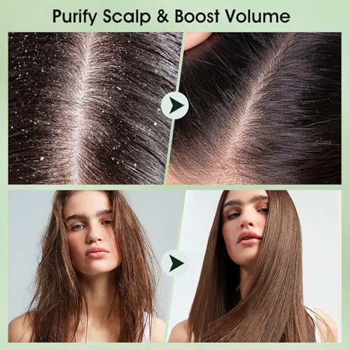 VOERUY Tea Tree Scalp Scrub Shampoo 2-in-1 Exfoliator with Mint Oil, 10.6oz