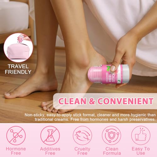 Urea Foot Callus Remover Stick - Moisturizing Heel & Skin Softening Treatment