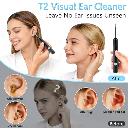 AudScope Black 1080P HD Ear Camera & Wax Removal Kit with LED Lights for Adults & Kids