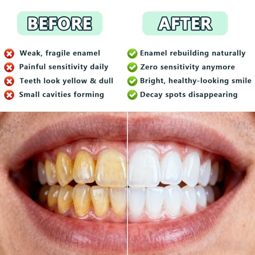 GFG Nano Natural Probiotic Hydroxyapatite Toothpaste 2pcs - Fluoride-Free, Sensitive & Fresh Mint