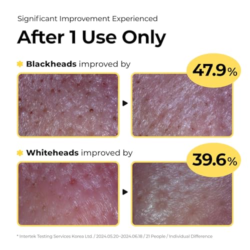 SINSURU Sulfur Mineral Cleansing Powder for Radiant Skin, 1.76 oz