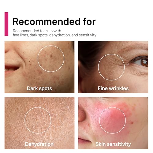 CELDYQUE ArbuTXA Cream – 7% Arbutin + Tranexamic Acid 5% + Niacinamide for Dark Spots & Uneven Skin Tone