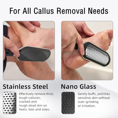 Dual-Sided Foot File Callus Remover for Pedicure & Exfoliation