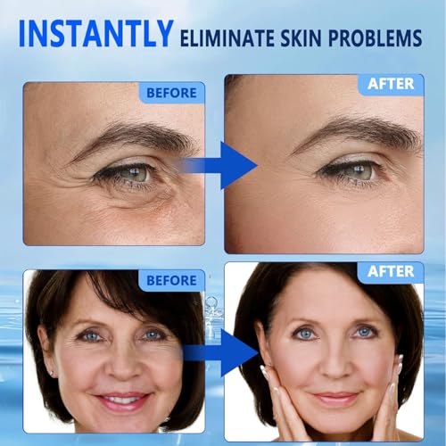 Rexibuz Face Lifting Serum - Anti-Aging Hydration Duo with Peptide & Collagen, 30ml