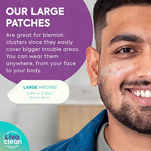 LivaClean Large Hydrocolloid Acne Patches 40CT (Pack of 2) - Overnight Treatment for Cystic Pimple & Zit Relief