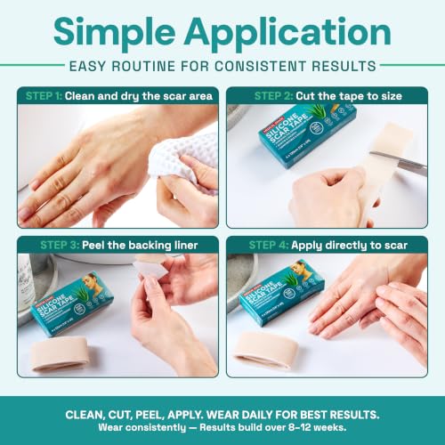 Silicone Scar Tape & Sheets for Surgical Scars | Medical Grade