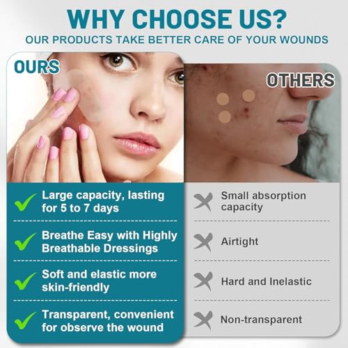 Hydrocolloid Pimple Patch Roll - Customizable Acne Treatment