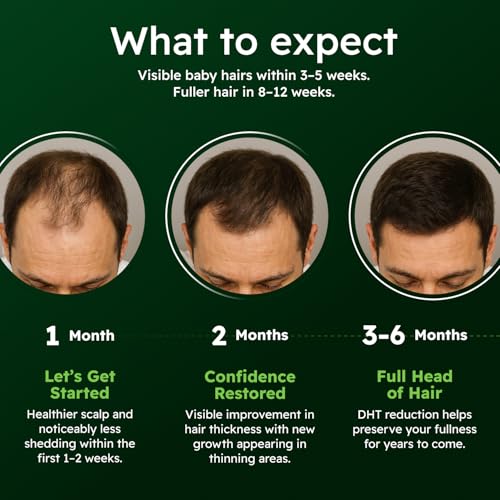 AlphaInfuse¢â Scalp Nourishing Serum for Men ? Ginseng & Eclipta Botanical Blend for Fuller-Looking, Thicker-Looking Hair and Healthy Scalp ? 32ml ? 2 Month Supply