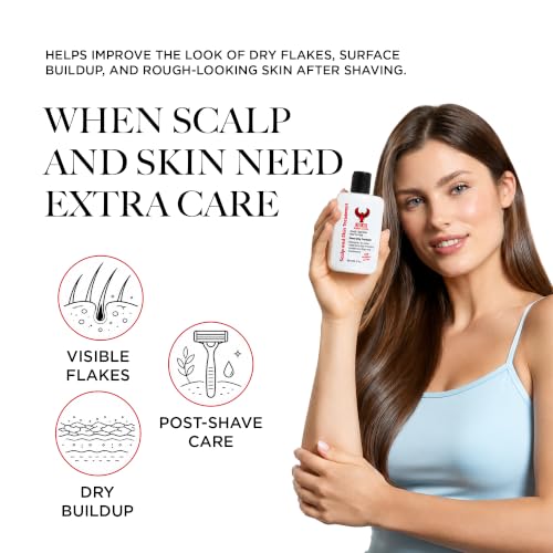 Kitikiti Scalp & Skin Treatment for Razor Bumps & Itchy Skin - 4 oz