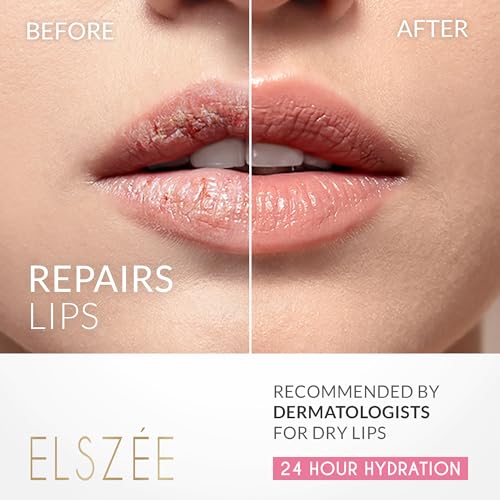 ELSZÉE Lip Mask with Hyaluronic Acid – Hydrating, Plumping Overnight Treatment