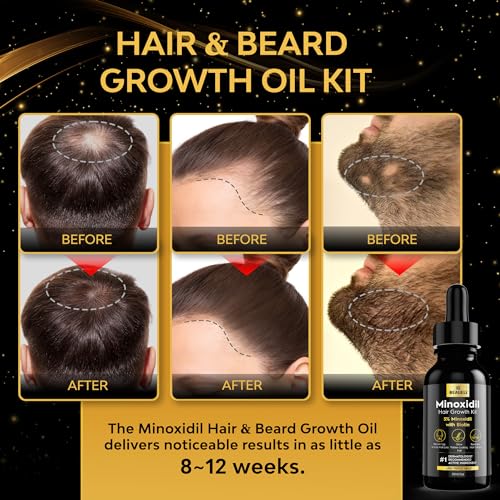 Beaueli Minoxidil Beard Growth Kit For Men and Women, Hair Loss and Hair Regrowth Treatments, Minoxidil 5%, Black