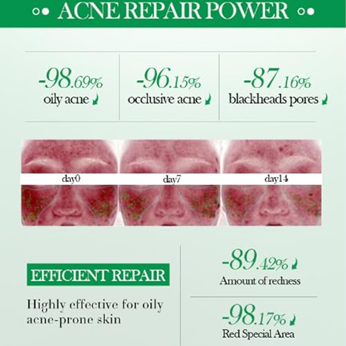 Grospe Salicylic Acid Repair Cream 1.78 Fl Oz - Acne & Pore Shrinkage Moisturizer for Oily Skin (Pack of 2)