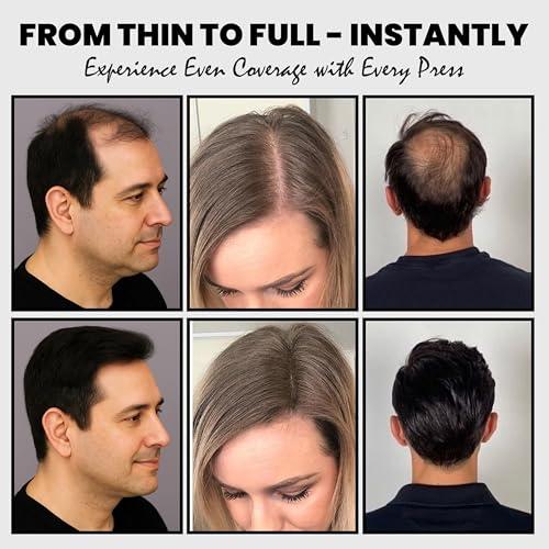 2PCS Dark Brown Hair Fibers for Thinning Hair - Long-Lasting Hair Building Spray with Applicator & Refill Pack, Instant Coverage, 30g+25g