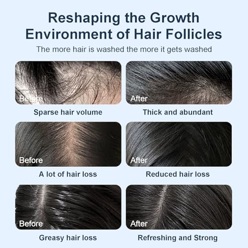 Tgideas Rosemary Hair Growth Shampoo with Biotin for Thinning Hair