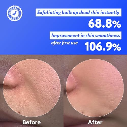 Coconut Jelly Pudding Cleanser - Deep Pore Cleanser & Gentle Exfoliation