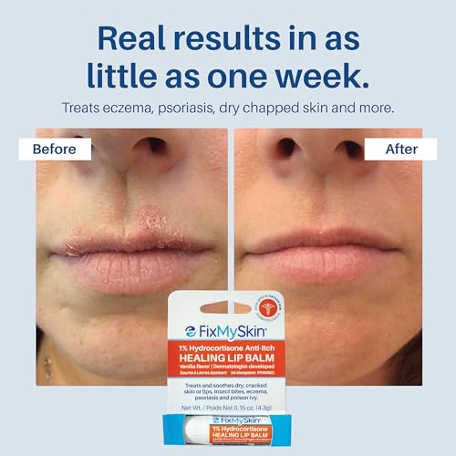 FixMySkin 1% Hydrocortisone Healing Lip Balm - Vanilla, 0.15 oz