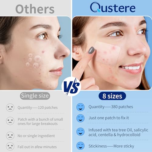 QUSTERE Hydrocolloid Acne Patches - 380 Count Variety Pack for Face