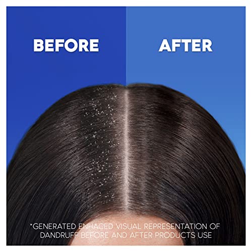 Head & Shoulders Classic Clean Anti-Dandruff Shampoo 250ml
