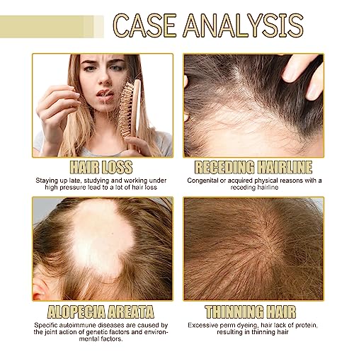 HuaQing 180 ML Rosemary Hair Growth Oil - 3 Pcs for Damaged Hair