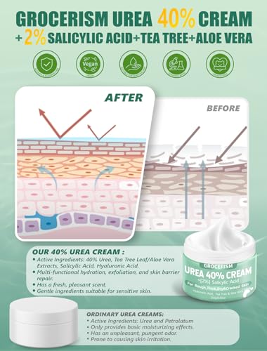 Grocerism 40% Urea Foot Cream with Salicylic Acid, 5.29oz - Softens Dry, Callused Skin