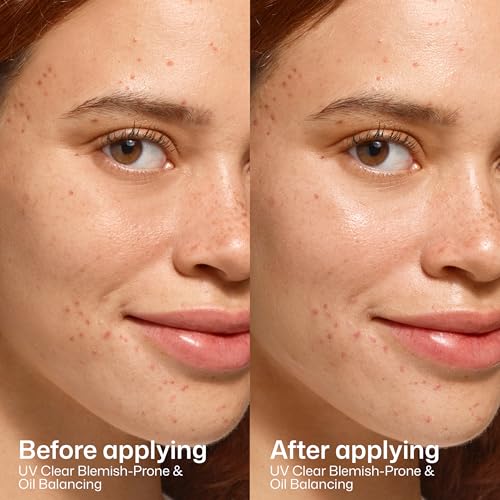 EltaMD UV Clear Blemish-Prone & Oil Balancing SPF 50, Non-Comedogenic Sunscreen with Zinc Oxide, Dermatologist Recommended