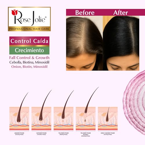 Rose Jolie Onion & Biotin Hair Growth Bundle | 3 Items | Shampoo 17 oz, Hair Mask 16 oz & Leave In Conditioner 10 oz | Hair Fall Control | Sulfate Free Paraben Free