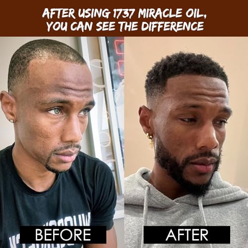 Dixon's 1737 Miracle Oil - Organic Beard, Hair & Scalp Oil (2 fl oz)
