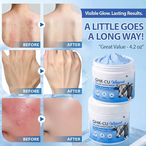 Copper Peptide Moisturizer with Beef Tallow & Honey – Anti-Aging Balm for Face & Neck, 4 oz