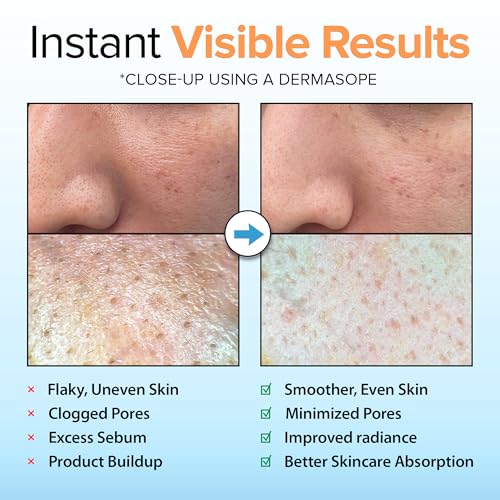 Ebanel Brightening Peeling Gel for Face and Body - Gentle Exfoliator