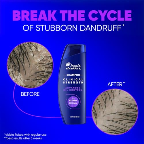 Head & Shoulders Clinical Strength Anti-Dandruff Shampoo with 1% Selenium Sulfide, 13.5 fl oz