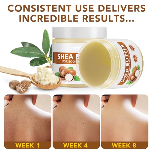 Pure Raw Shea Butter - Deeply Moisturizing Body Butter for Dry Skin, 7.8 oz