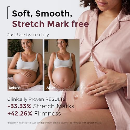 Momcozy Stretch Mark Prevention Cream, Travel Size Belly Moisturizer for Dry Skin, Peptides & Shea Butter, EWG Verified, Dermatologist Tested Maternity Care, 1.06 oz (30g)