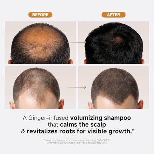 Anti Hair Loss Shampoo for Men & Women with Ginger & Castor Oil - 16.8 fl. oz